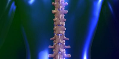 spinal-cord-stimulation-e1418434657458